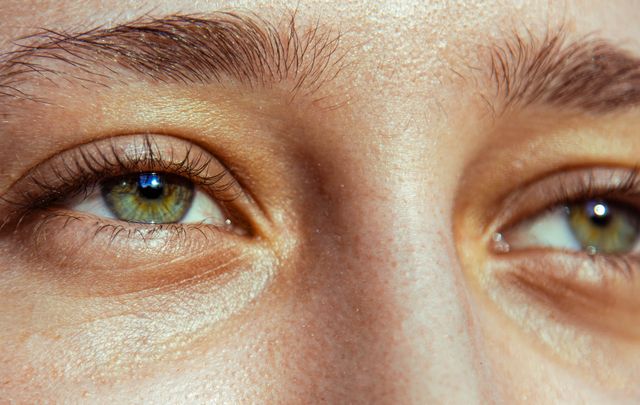 Factors That Can Affect Eyes Look